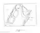 Fig. 06 - Orthosis for a gait modulation system