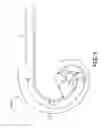 Fig. 06 - Delivery catheter