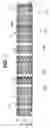 Fig. 02 - Systems and methods for securing graft material to intraluminal devices