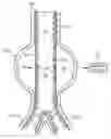 Fig. 01 - Endoluminal device and system and method for detecting a change in pressure differential across an endoluminal device
