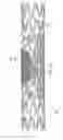 Fig. 24 - Stent with spiral side-branch