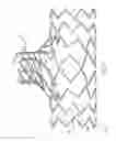 Fig. 25 - Stent with spiral side-branch