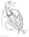 Application 20070112422, fig. 01
