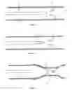 Fig. 04 - Devices and methods for treatment of venous valve insufficiency
