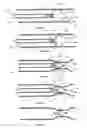 Fig. 13 - Devices and methods for treatment of venous valve insufficiency