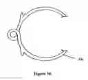 Fig. 14 - Devices and methods for treatment of venous valve insufficiency