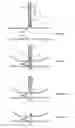 Fig. 19 - Devices and methods for treatment of venous valve insufficiency