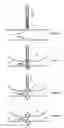 Fig. 20 - Devices and methods for treatment of venous valve insufficiency