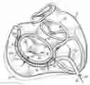 Fig. 01 - CATHETER BASED TISSUE FASTENING SYSTEMS AND METHODS