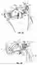 Fig. 13 - CATHETER BASED TISSUE FASTENING SYSTEMS AND METHODS