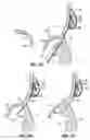 Fig. 23 - CATHETER BASED TISSUE FASTENING SYSTEMS AND METHODS