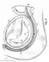 Fig. 27 - CATHETER BASED TISSUE FASTENING SYSTEMS AND METHODS