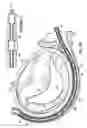 Fig. 29 - CATHETER BASED TISSUE FASTENING SYSTEMS AND METHODS