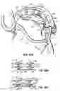 Fig. 42 - CATHETER BASED TISSUE FASTENING SYSTEMS AND METHODS