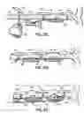 Fig. 45 - CATHETER BASED TISSUE FASTENING SYSTEMS AND METHODS