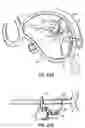 Fig. 46 - CATHETER BASED TISSUE FASTENING SYSTEMS AND METHODS