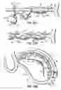 Fig. 47 - CATHETER BASED TISSUE FASTENING SYSTEMS AND METHODS