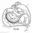 Fig. 49 - CATHETER BASED TISSUE FASTENING SYSTEMS AND METHODS
