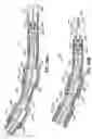 Fig. 53 - CATHETER BASED TISSUE FASTENING SYSTEMS AND METHODS
