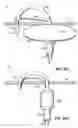 Fig. 58 - CATHETER BASED TISSUE FASTENING SYSTEMS AND METHODS