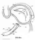 Fig. 61 - CATHETER BASED TISSUE FASTENING SYSTEMS AND METHODS