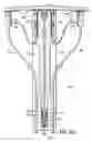 Fig. 63 - CATHETER BASED TISSUE FASTENING SYSTEMS AND METHODS