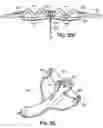 Fig. 66 - CATHETER BASED TISSUE FASTENING SYSTEMS AND METHODS