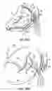 Fig. 68 - CATHETER BASED TISSUE FASTENING SYSTEMS AND METHODS
