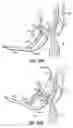 Fig. 70 - CATHETER BASED TISSUE FASTENING SYSTEMS AND METHODS
