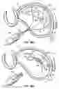 Fig. 71 - CATHETER BASED TISSUE FASTENING SYSTEMS AND METHODS