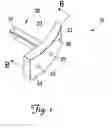 Fig. 02 - Facet repair and stabilization