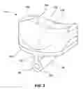 Fig. 04 - Artificial intervertebral disc