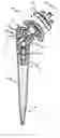Fig. 01 - ENDOPROSTHESIS FOR A SHOULDER JOINT