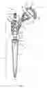 Fig. 02 - ENDOPROSTHESIS FOR A SHOULDER JOINT