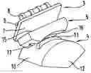 Fig. 01 - Ankle-joint endoprosthesis