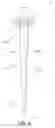 Fig. 05 - Method of implanting using a set of femoral prostheses
