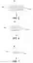 Fig. 06 - Method of implanting using a set of femoral prostheses