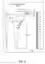 Fig. 07 - Method of implanting using a set of femoral prostheses