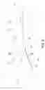 Fig. 08 - Method of implanting using a set of femoral prostheses