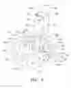 Fig. 04 - BALL AND SHAFT OF JOINT PROTHESIS