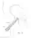 Fig. 09 - BALL AND SHAFT OF JOINT PROTHESIS