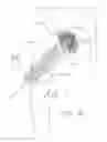 Fig. 18 - BALL AND SHAFT OF JOINT PROTHESIS