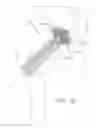 Fig. 19 - BALL AND SHAFT OF JOINT PROTHESIS