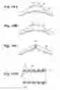 Fig. 10 - Anti-reflux stent