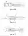Fig. 11 - Anti-reflux stent