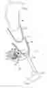 Fig. 01 - Power evacuation valve for prosthetic limb socket