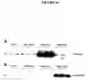 Fig. 20 - Recombinant DNA constructs compressing engineered plant microRNAs and methods for controlling gene expression