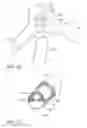 Fig. 08 - Air circulation system for protective helmet and helmet containing the same