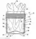 Fig. 01 - Pocket apparatus for holding a sheet of material