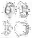 Fig. 03 - Goggle with interchangeable vent accessories
